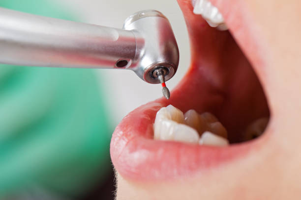 Best Dentist for Tooth Abscess  in Spring Creek, NV